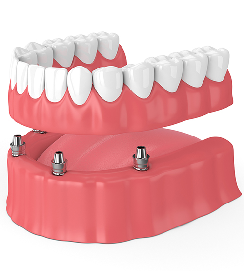 Prothese-Dentiste-Montargis Dentiste Montargis